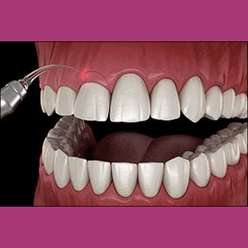 Best Dental Gum Surgery in South Bopal, North Bopal, Sobo Center, Ghuma, Shela and Ahmedabad