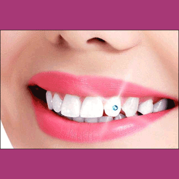 Best Dental Teeth Jewellery in South Bopal, North Bopal, Sobo Center, Ghuma, Shela and Ahmedabad