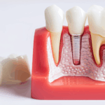 Dental Client in South Bopal