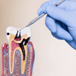 Best Dental Clinic in Ahmedabad