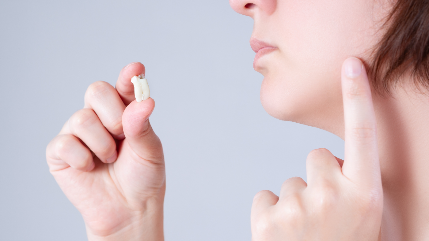 Wisdom Tooth Removal