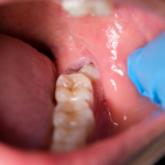 Dental Clinic in Bopal