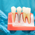 Advanced Root Canal Treatment with Modern Technology for Comfortable and Effective Tooth Infection Care