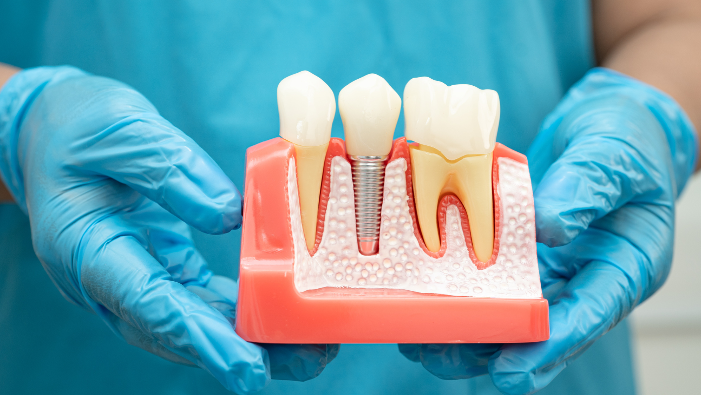 Advanced Root Canal Treatment with Modern Technology for Comfortable and Effective Tooth Infection Care